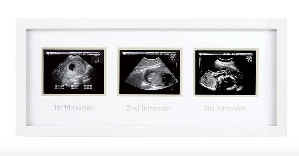 Trimester Sonogram Frame, White